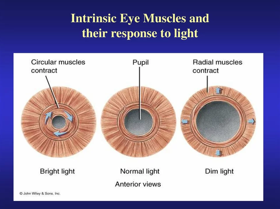 Pupil Constriction: What Causes Myosis?